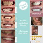 Hochwertiges Teeth whitening kit UniqueSmile – Bild 5