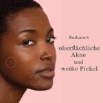 Rael Hydrokolloid Akne Pimple Patch - Unsichtbar, Makelfleck, Hydrokolloid, Hautbehandlung, zwei Grössen (96 count) – Bild 4