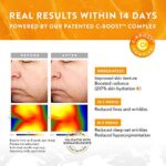 Bio-Vitamin C Serum für das Gesicht MIT HYALURONSÄURE +RETINOL +FERULATSÄURE +JOJOBA-ÖL +VIT E - Anti Aging Aufhellendes Gesichtsserum für reinen Hautglanz - Reduziert Falten & dunkle Flecken (Vegan) – Bild 2