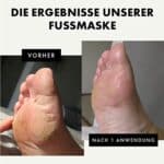 Eclat Skincare, Peeling Maske für weiche Babyfüsse, 1 Paar Peeling Masken Socken repariert raue Fersen, entfernt trockene, abgestorbene Haut, feuchtigkeitsspendende Fuss Peeling Maske für harte Haut, Hornhaut – Bild 3