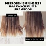 Eclat Skincare, Haarwuchsshampoo für Männer & Frauen, Koffeinbehandlung mit Rizinusöl & Arganöl, schnell wachsende, verdickende Formel für Haarausfall/schütteres Haar, sulfatfreies Shampoo – Bild 3