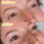before and after