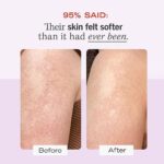 First Aid Beauty KP Bump Eraser Körperpeeling, Body Scrub, Peeling gegen Pickel für den Körper, mit 10% AHA, Haut mit Keratosis Pilaris, Sensible Hautpflege, 226g – Bild 4