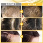 before and after