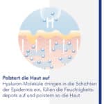 polstert die haut auf