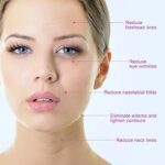 MYCARBON Gesichtsmassagegerät - Hautstraffung & Lifting, wasserdicht – Bild 4