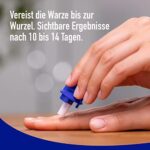 WARTNER Warzen Vereisung