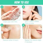 Hydrokolloid Pimple Patches mit Teebaumöl – Unsichtbar, Tag & Nacht, Wasserdicht & Atmungsaktiv